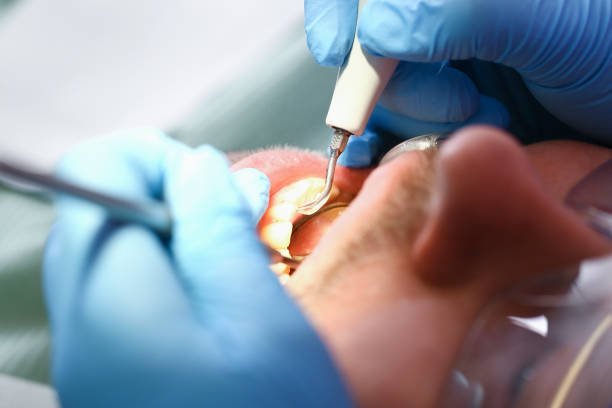 Best After-Hours Dental Trauma Care in Bear Creek, AK