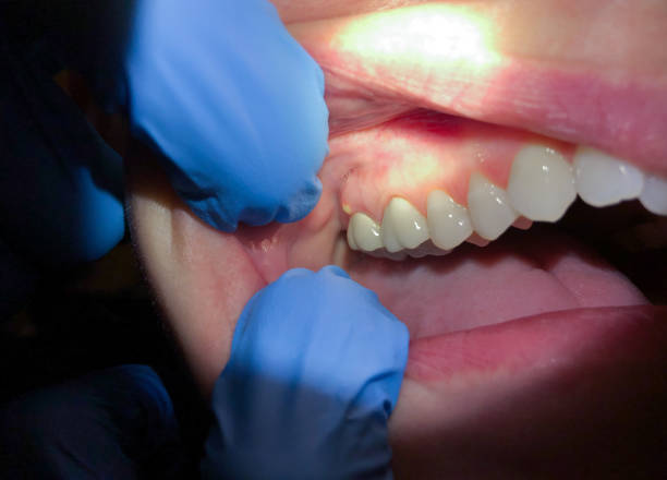 Best Same-Day Emergency Dental Services in Bear Creek, AK